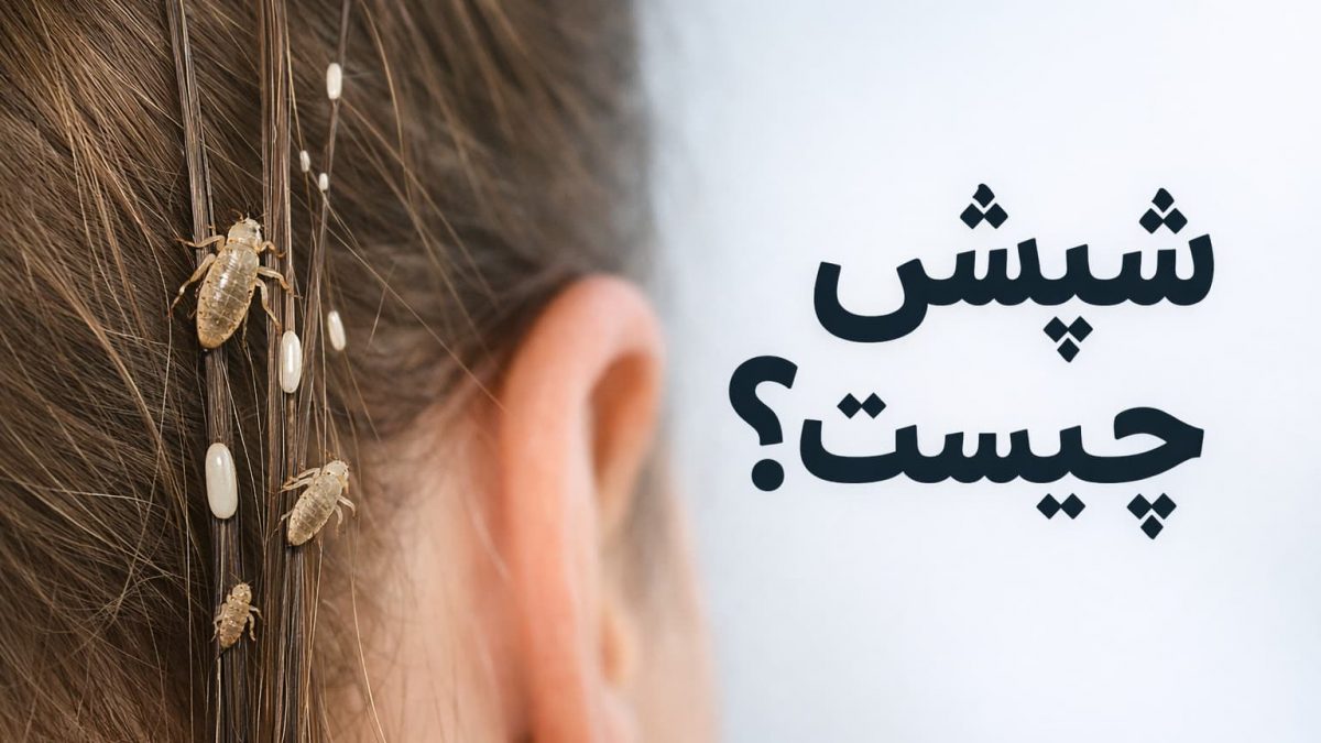 شپش چیست؟