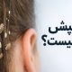 شپش چیست؟