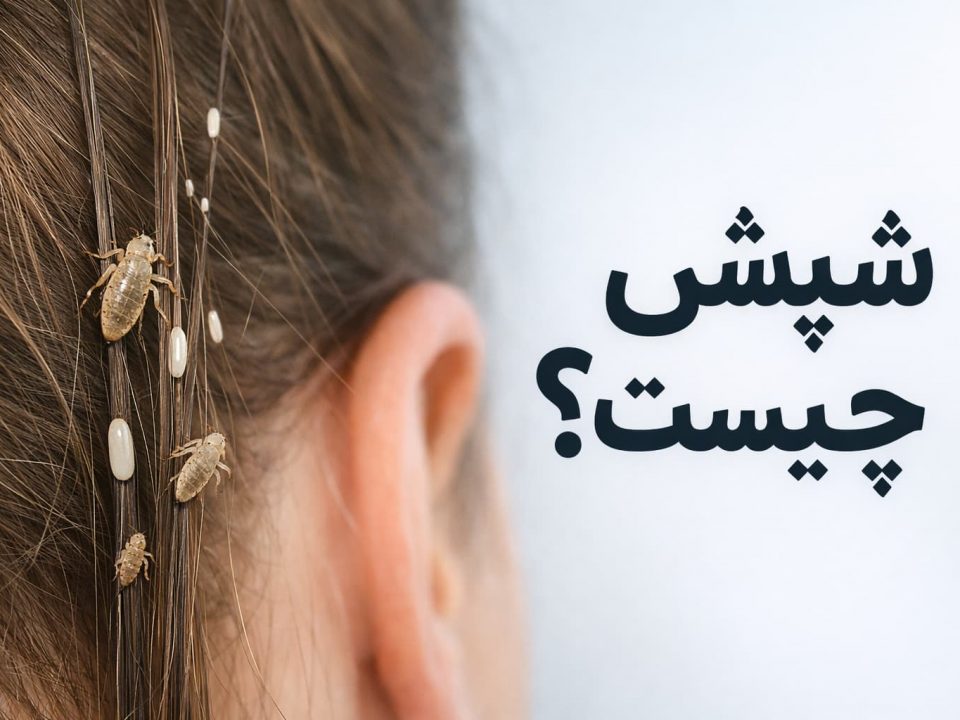شپش چیست؟